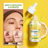 Das Lemon VC-Gesichtsserum hellt den Hautton auf und entfernt