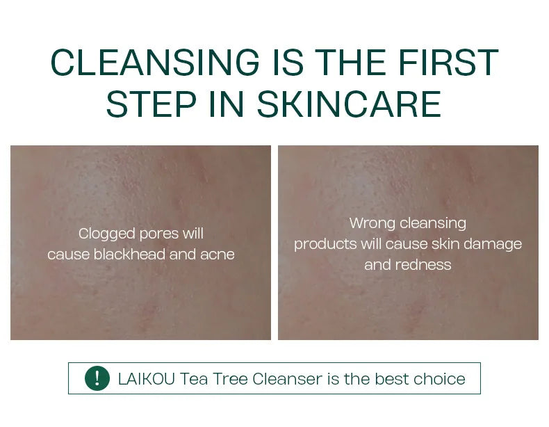 LAlKOU Tea Tree Cleanser Gentle Acne Treatment Blackhead Cleaner Shrink Pore Deep Clean Oil Control Moisturizing Face Skin Care