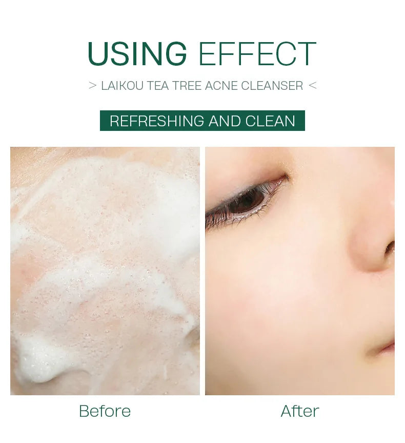 LAlKOU Tea Tree Cleanser Gentle Acne Treatment Blackhead Cleaner Shrink Pore Deep Clean Oil Control Moisturizing Face Skin Care