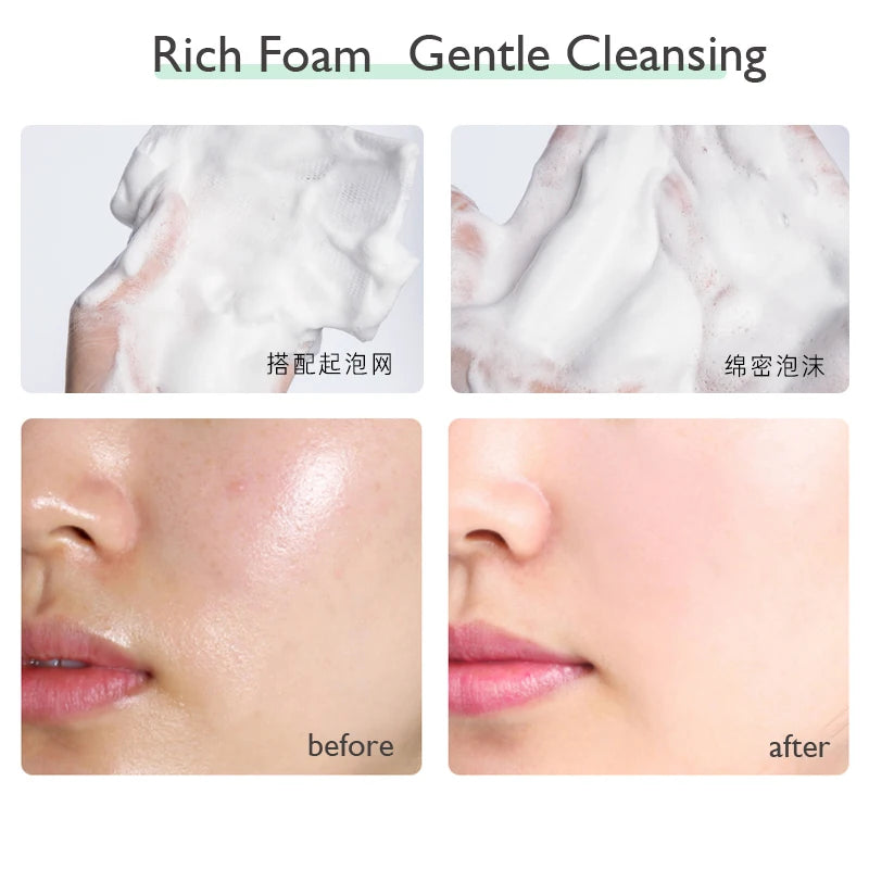 PTWOP Whitening Facial Cleanser Foam Moisturizing Deep Remove Cleansing Acne Milk Oil Control Exfoliating Shrink Pores Face Wash