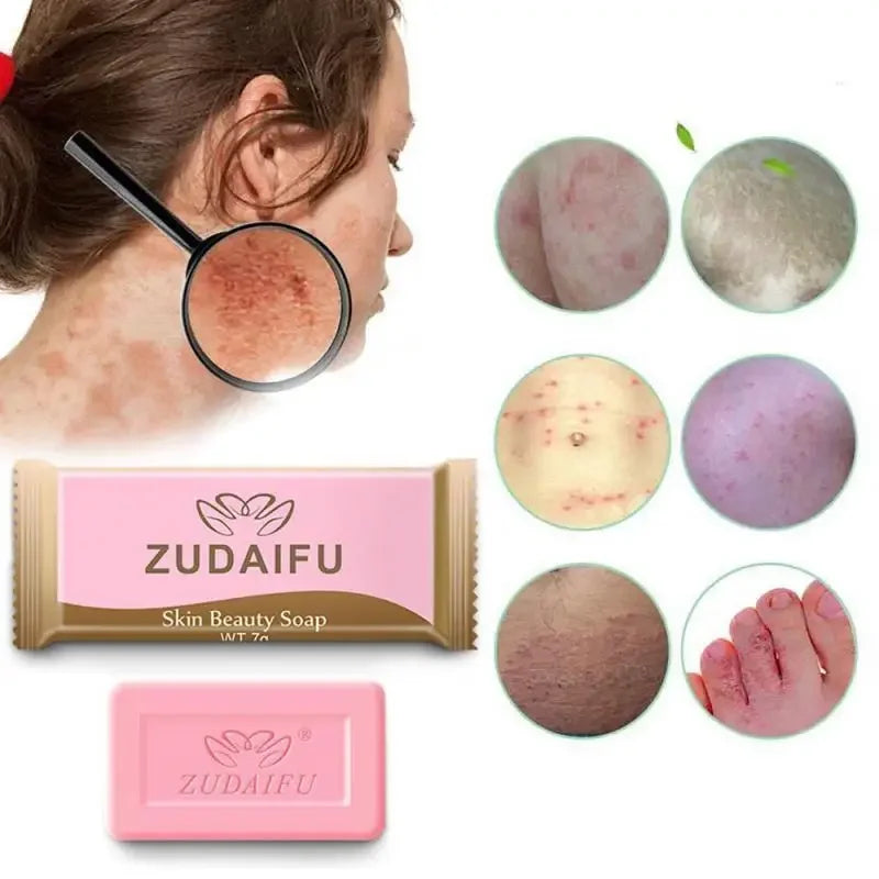 바디워시 Sulfur Anti-mites Anti-acne Body Cleansing Skin Treatment Soap  Anti Fungus Soap Beauty Health Kojic Acid Soap Kojic Acid
