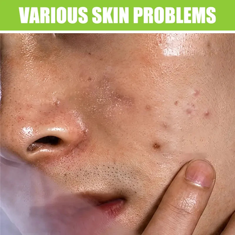 YUITIKUE Men's Facial Wash 60g - Green Tea & Salicylic Acid, Deep Cleansing, Oil Control, Tea Tree & Charcoal, For Men