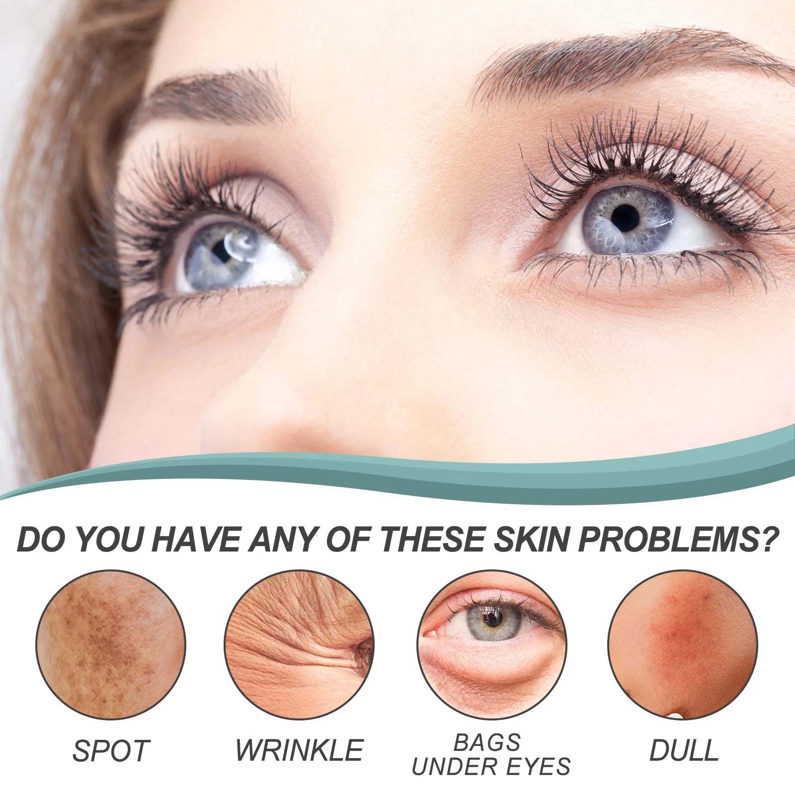 EELHOE Whitening Freckle Cream Nicotinamide Dark Spot Remover Skin Care Moisturizing Brighten Anti-aging Fade Spot Face Beauty